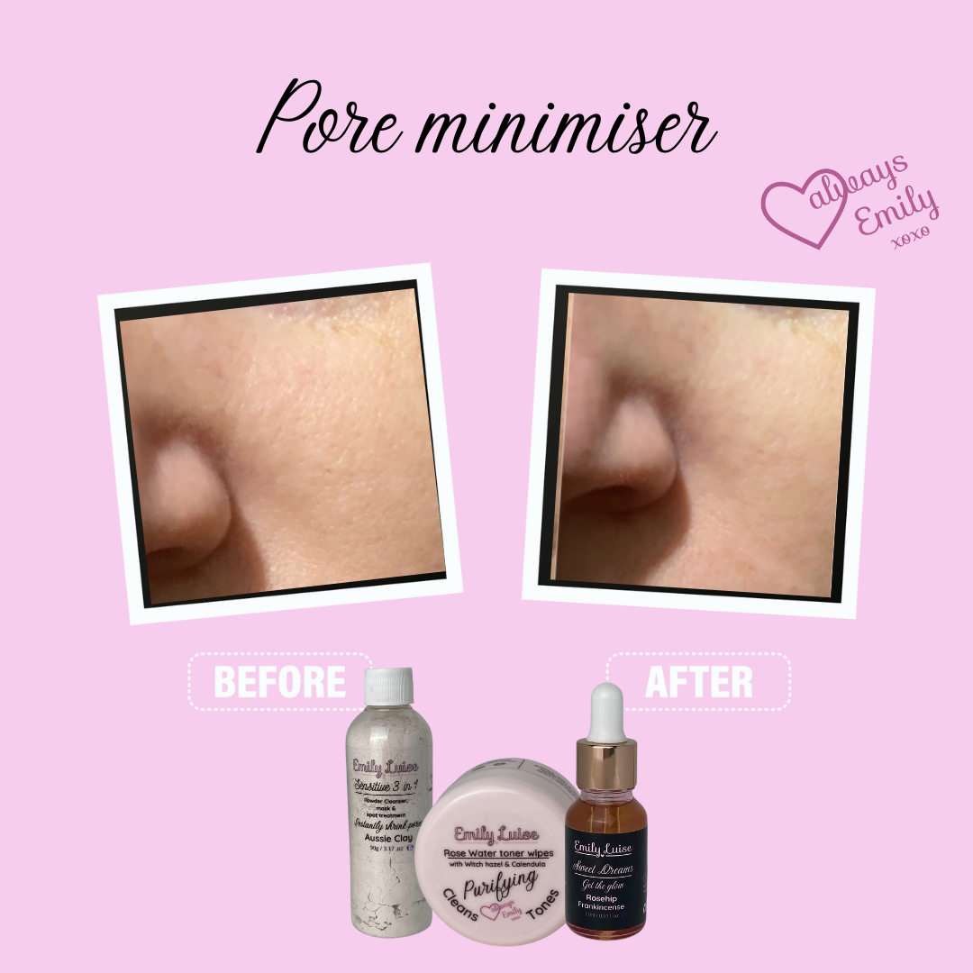 Before and after of minimised pores. 