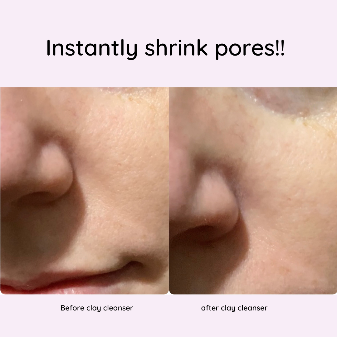 Left side pic of visible pores and right size pic of minimised pores. 